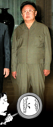 일본 언론에 보도된 김정일 중병설