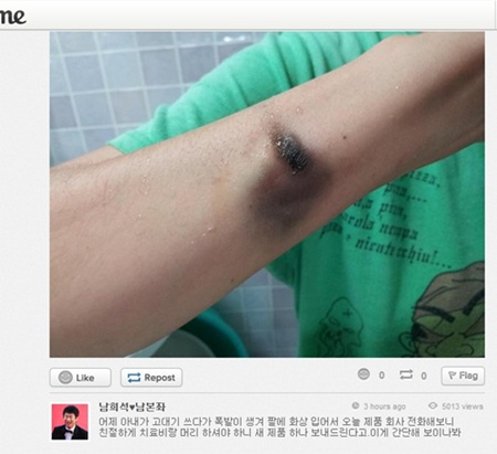 남희석 아내 고데기 폭발로 화상 "업체 전화했더니…"