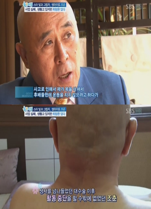 '쌍라이트' 조춘 활동중단 이유 "운동하다 사고로 목에 철심 박았다"