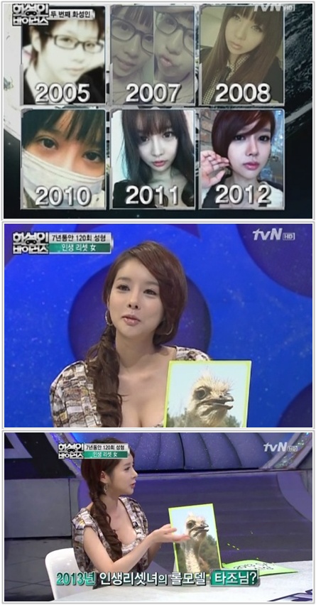 '인생리셋녀' 7년 변천사…"성형 120회 후 외모·애인 레벨 업"
