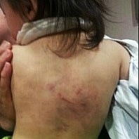 부산 어린이집 여교사들 17개월짜리 여아 폭행 이유…"징징거려서 때렸다"