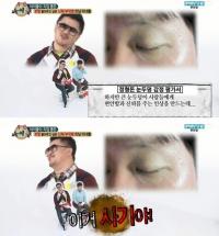 정형돈 눈두덩 감정 평가하니 피곤해 보이지만 신뢰간다? '천 만원' 책정
