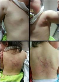 'CCTV 의무화' '어린이 폭행 교사 구속' 네티즌 부글부글