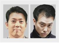 탈모위험도 공개에 이휘재 ‘안도’ 은지원 ‘경악’…스트레스가 원인