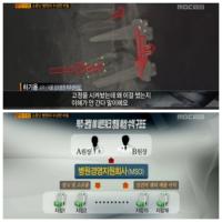 'PD 수첩', 과잉진료·탈법의 온상 네트워크 병원 실태 고발