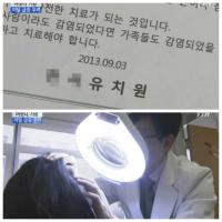 어린이집, '후진국 병' 머릿니 주의보…신체접촉이 주요 요인