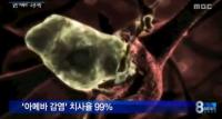 '치사율 99%' 뇌먹는 아메바 美 수돗물서 발견, 감염 경로는?