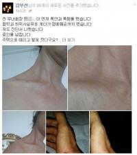 김부선, 반상회에서 주민 폭행 혐의…“먼저 폭행 당했다 ” 주장