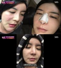 '한밤' 에이미 폭행사진 공개…억울하게 맞아 VS 부부싸움 원인 '날선 공방'
