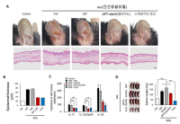 KAIST, 나노입자로 건선, 아토피 치료 성공