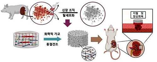 신속한 지혈과 창상 회복을 돕는 신장 ECM 기반 스펀지 소재 제작 및 작용 모식도. 자료=대구한의대 제공